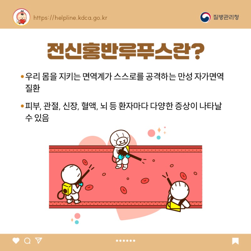 우리반 아이, 이런 병이 있다면_전신홍반루푸스_카드뉴스.jpg